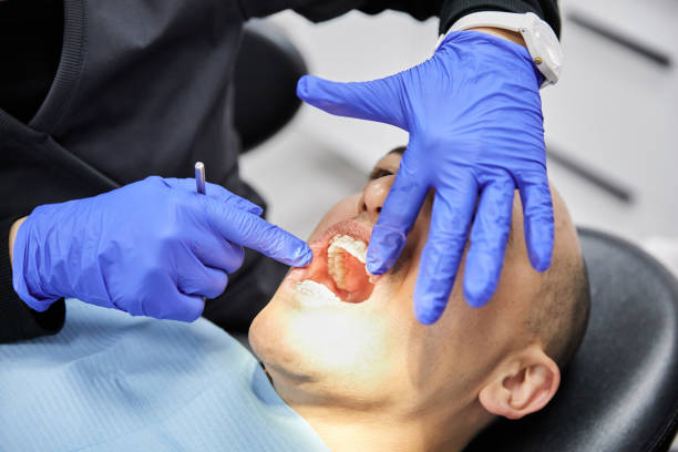 Best Urgent Care for Lost Fillings or Crowns in Rosenberg, TX