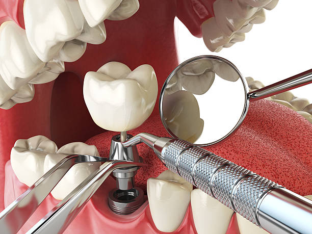 Best Same-Day Emergency Dental Services in Rosenberg, TX