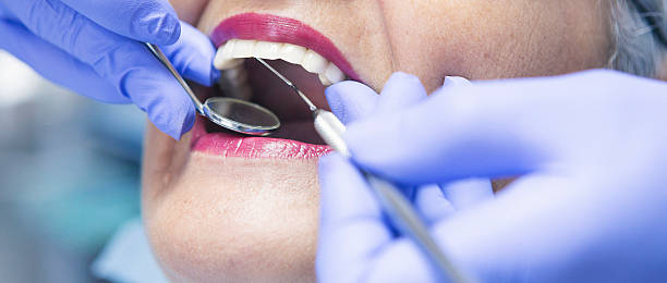 Best Emergency Dental Care for Broken or Chipped Teeth in Rosenberg, TX